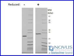Novus Biologicals™ Recombinant Human WISP2 Animal-Free Protein